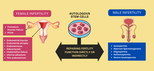  Stem Cells can be used for restoring noral fertility function in Infertile women and Men- premise of restorative reproductive medicine.