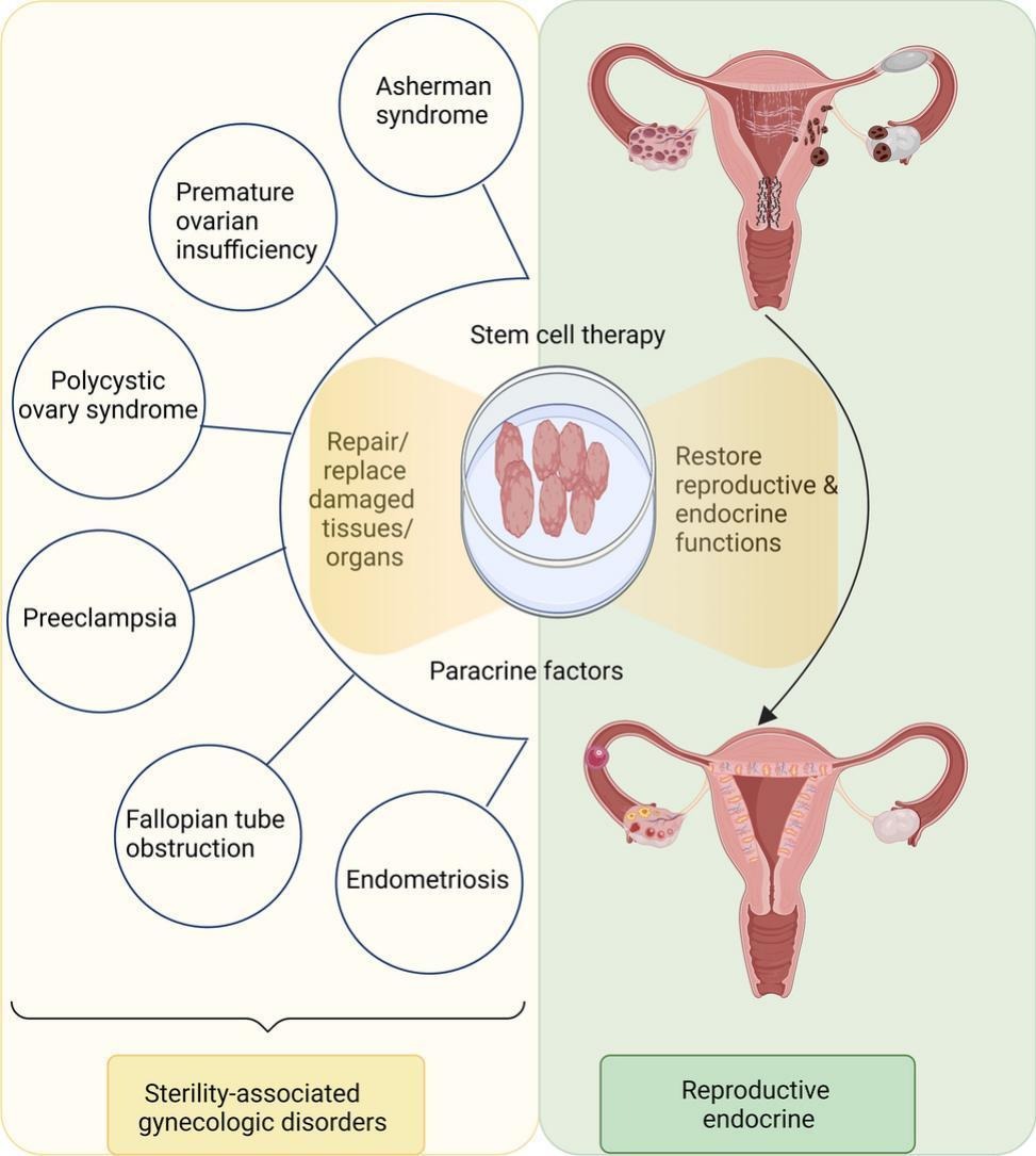 Reproductive Regenerative Medicine via Stem-Cell Therapy