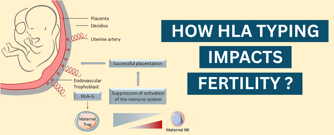 Understanding HLA compatibility between couples and its role in infertility